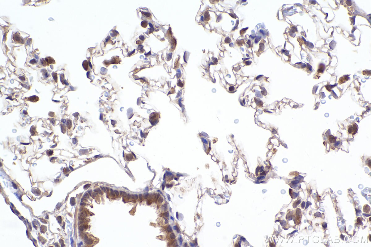 Immunohistochemical analysis of paraffin-embedded rat lung tissue slide using KHC2370 (GPSM2 IHC Kit).