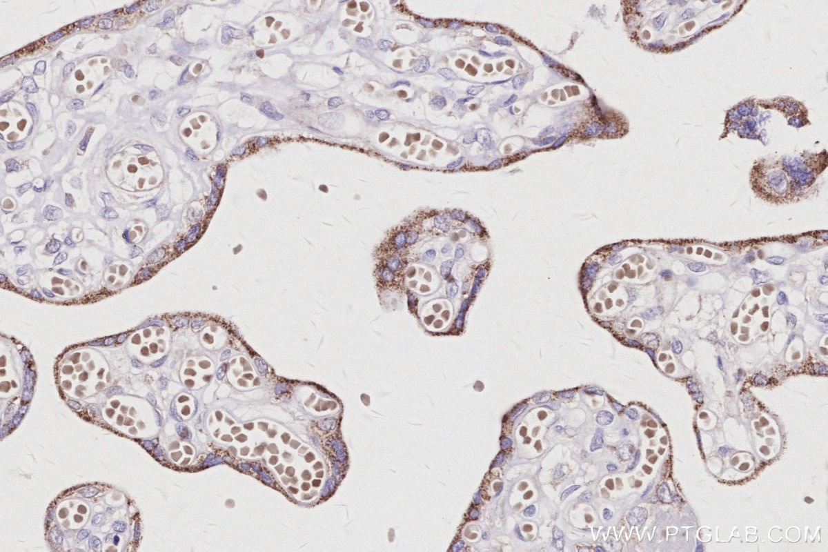 Immunohistochemical analysis of paraffin-embedded human placenta tissue slide using KHC3042 (GRAF IHC Kit). Immunohistochemical analysis of paraffin-embedded human placenta tissue slide using KHC3042 (GRAF IHC Kit).