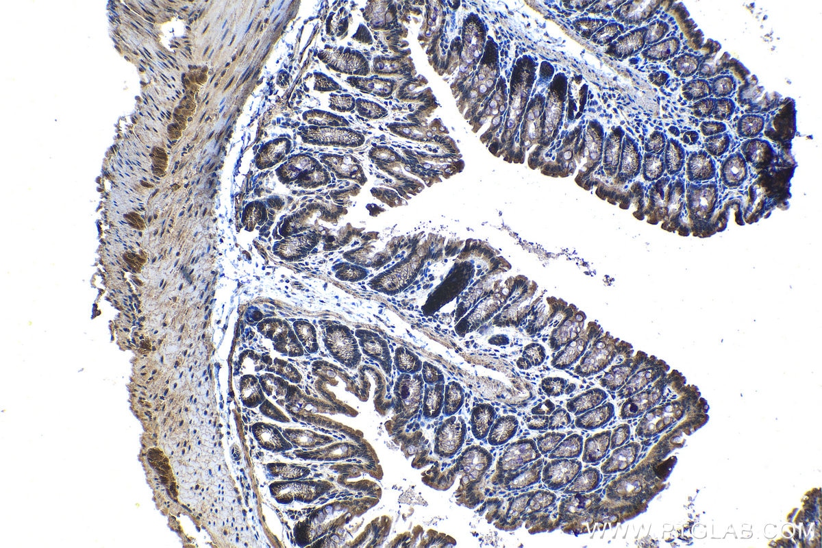 Immunohistochemical analysis of paraffin-embedded mouse colon tissue slide using KHC1285 (GRB7 IHC Kit).