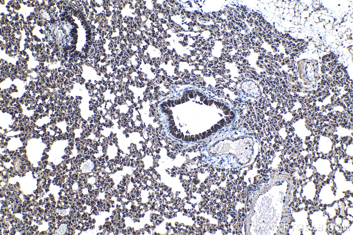 Immunohistochemical analysis of paraffin-embedded mouse lung tissue slide using KHC1285 (GRB7 IHC Kit).