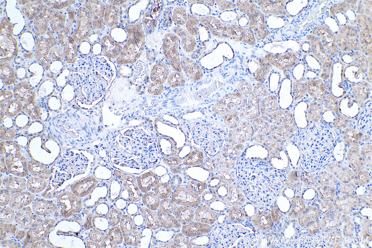 Immunohistochemical analysis of paraffin-embedded human kidney tissue slide using KHC0520 (GRHPR IHC Kit).