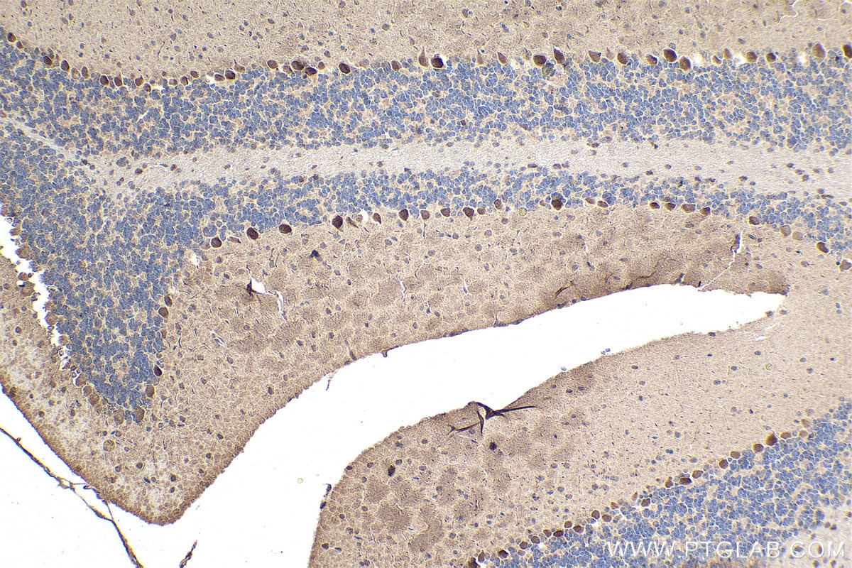 Immunohistochemical analysis of paraffin-embedded mouse cerebellum tissue slide using KHC1581 (GRK5 IHC Kit).