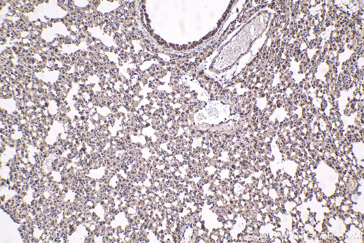 Immunohistochemical analysis of paraffin-embedded mouse lung tissue slide using KHC1581 (GRK5 IHC Kit).