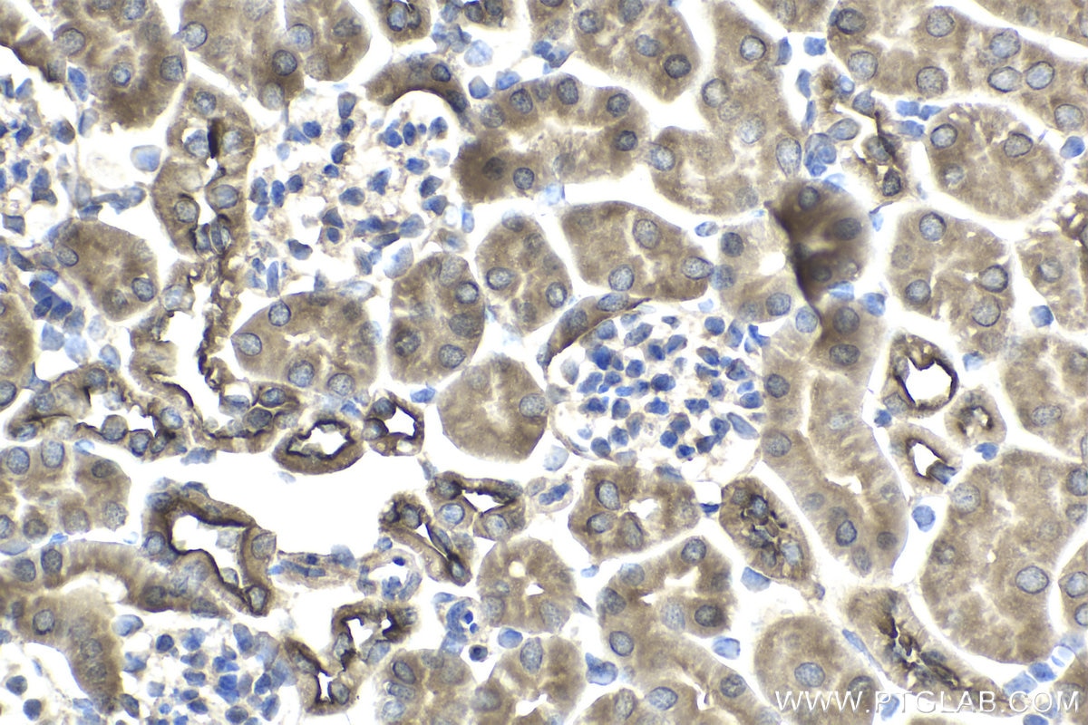 Immunohistochemical analysis of paraffin-embedded mouse kidney tissue slide using KHC1963 (GRLF1 IHC Kit).