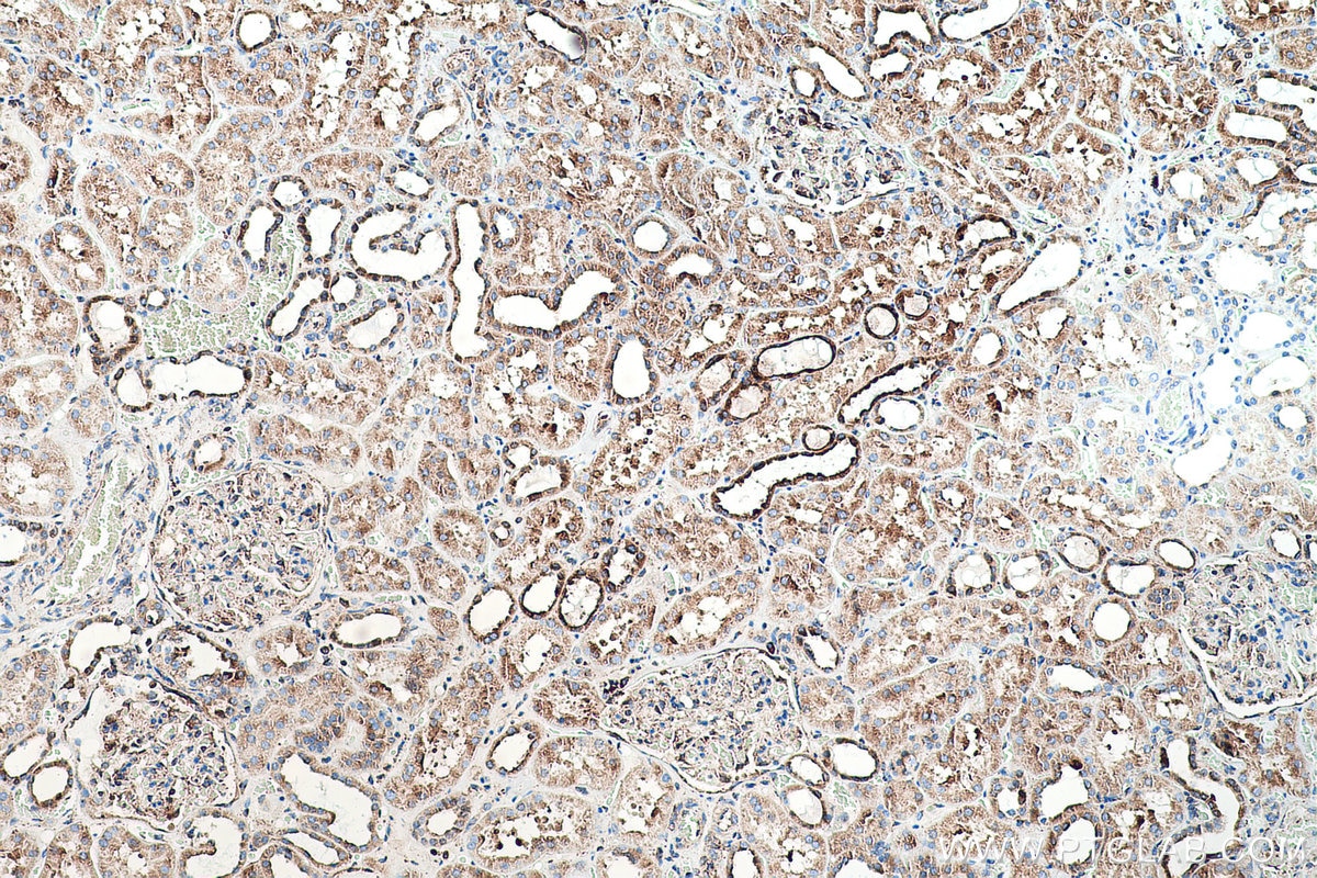 Immunohistochemical analysis of paraffin-embedded human kidney tissue slide using KHC0509 (GRP78/HSPA5 IHC Kit).
