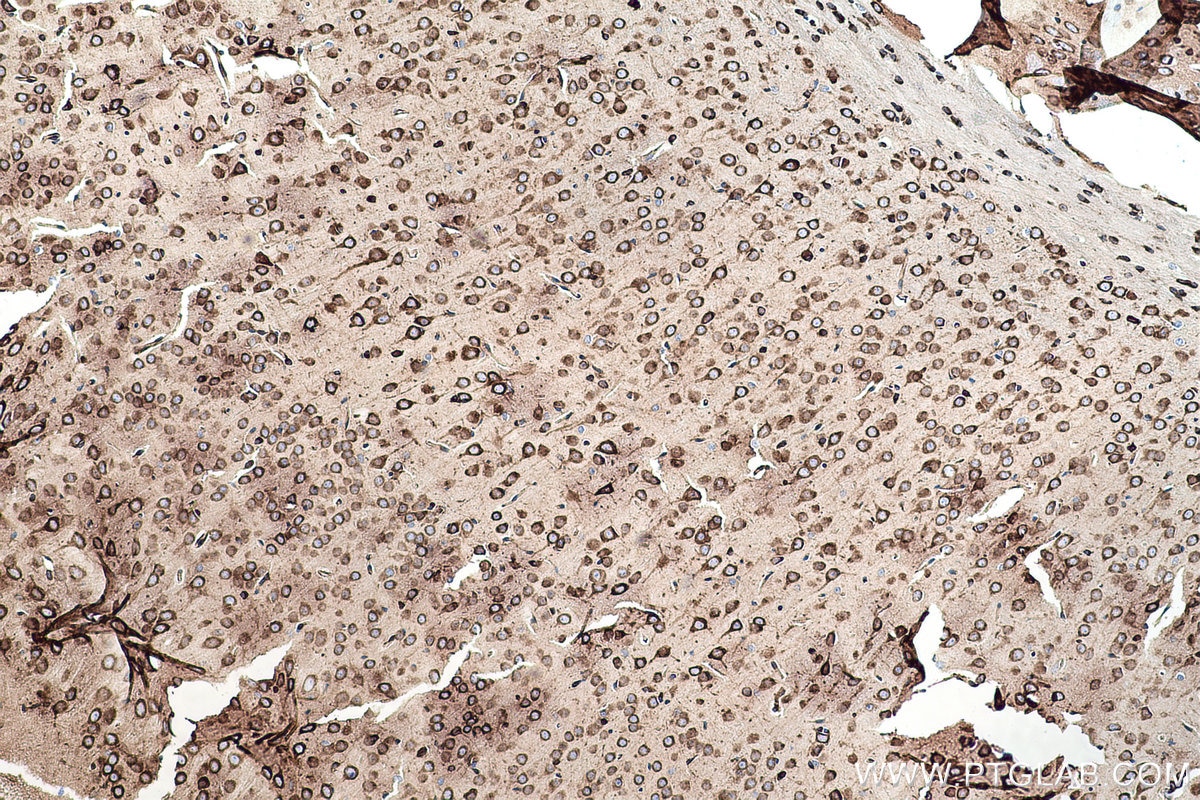 Immunohistochemical analysis of paraffin-embedded mouse brain tissue slide using KHC0509 (GRP78/HSPA5 IHC Kit).