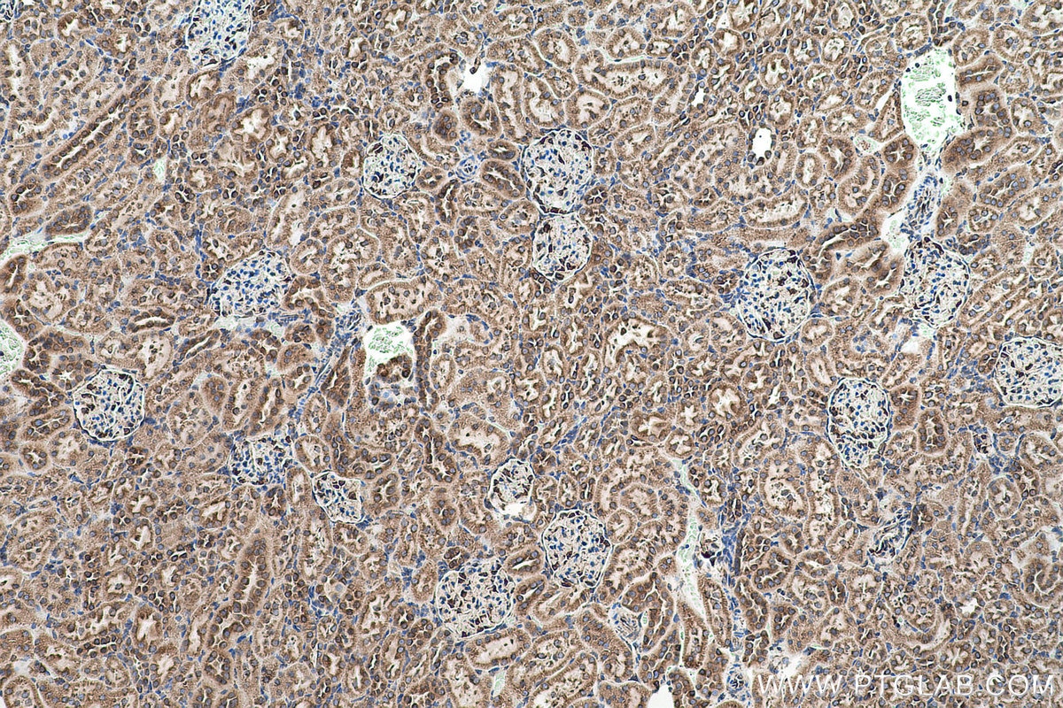 Immunohistochemical analysis of paraffin-embedded rat kidney tissue slide using KHC0509 (GRP78/HSPA5 IHC Kit).