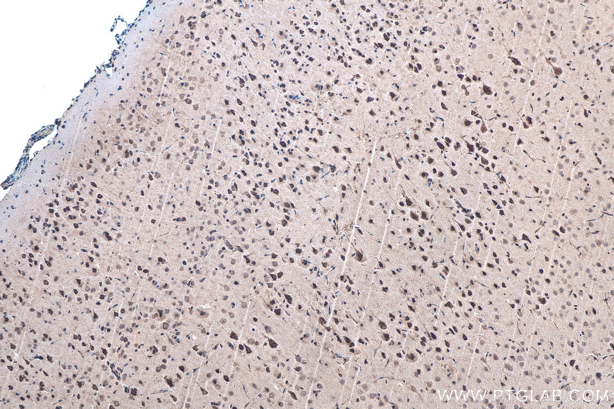 Immunohistochemical analysis of paraffin-embedded rat brain tissue slide using KHC0116 (GSK3B IHC Kit).