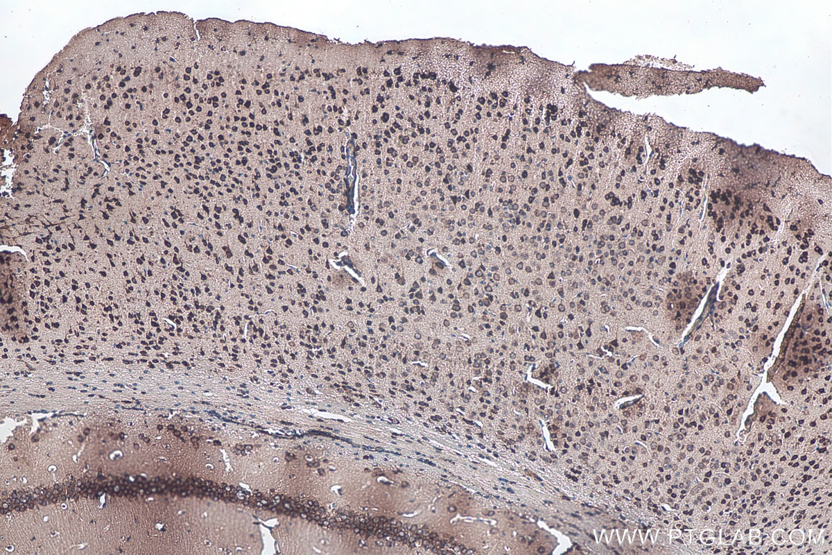 Immunohistochemical analysis of paraffin-embedded mouse brain tissue slide using KHC0116 (GSK3B IHC Kit).