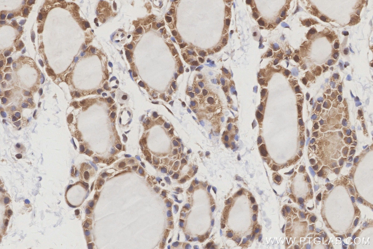 Immunohistochemical analysis of paraffin-embedded rat thyroid gland tissue slide using KHC3159 (GSR IHC Kit). Immunohistochemical analysis of paraffin-embedded rat thyroid gland tissue slide using KHC3159 (GSR IHC Kit).