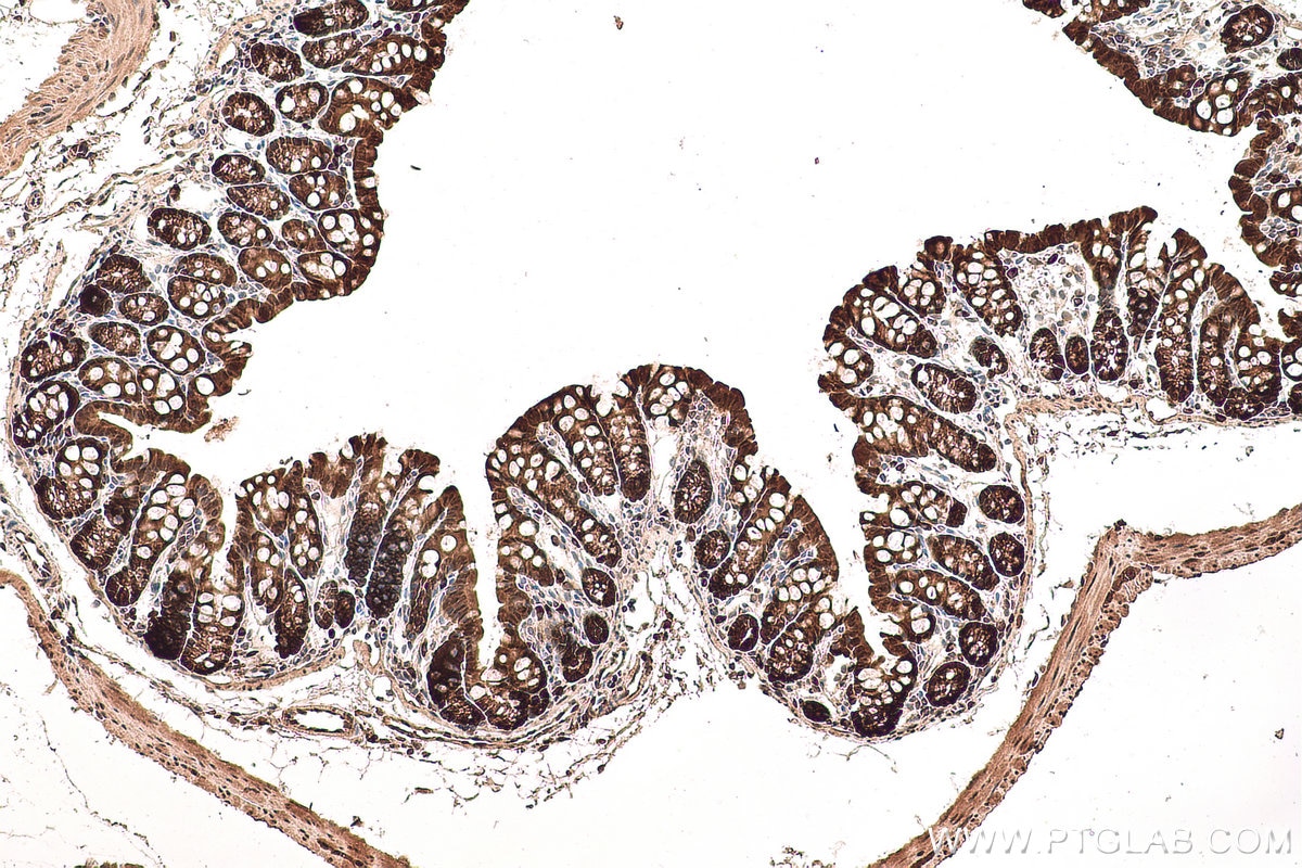 Immunohistochemical analysis of paraffin-embedded mouse colon tissue slide using KHC0781 (GSS IHC Kit).