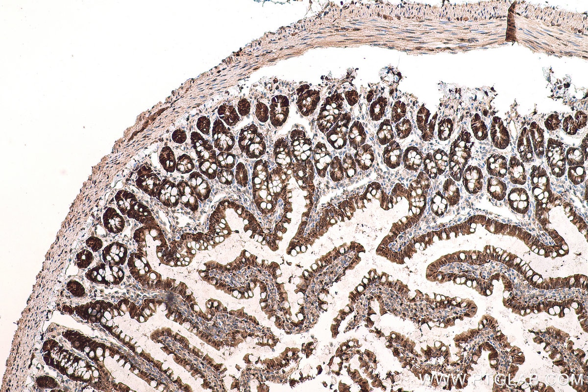 Immunohistochemical analysis of paraffin-embedded rat colon tissue slide using KHC0781 (GSS IHC Kit).