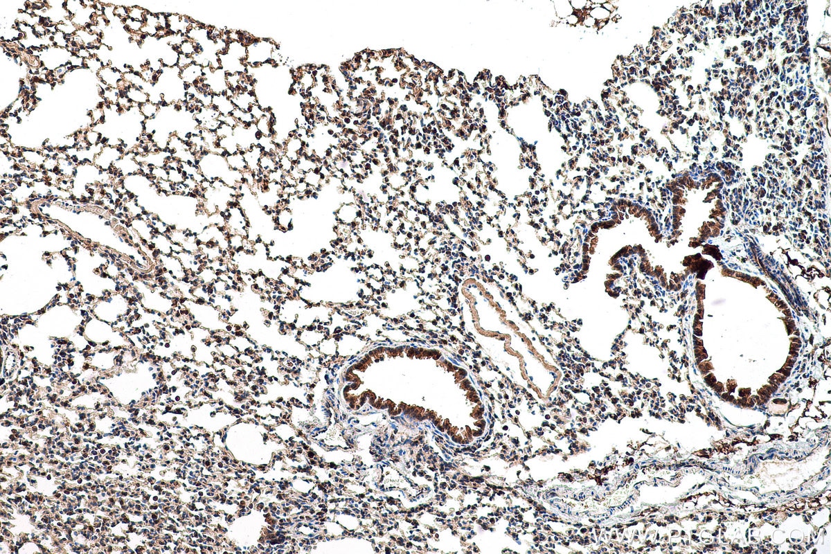 Immunohistochemical analysis of paraffin-embedded mouse lung tissue slide using KHC0787 (GSTCD IHC Kit).