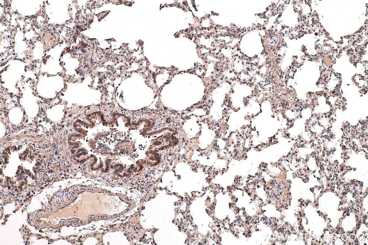 Immunohistochemical analysis of paraffin-embedded rat lung tissue slide using KHC0787 (GSTCD IHC Kit).