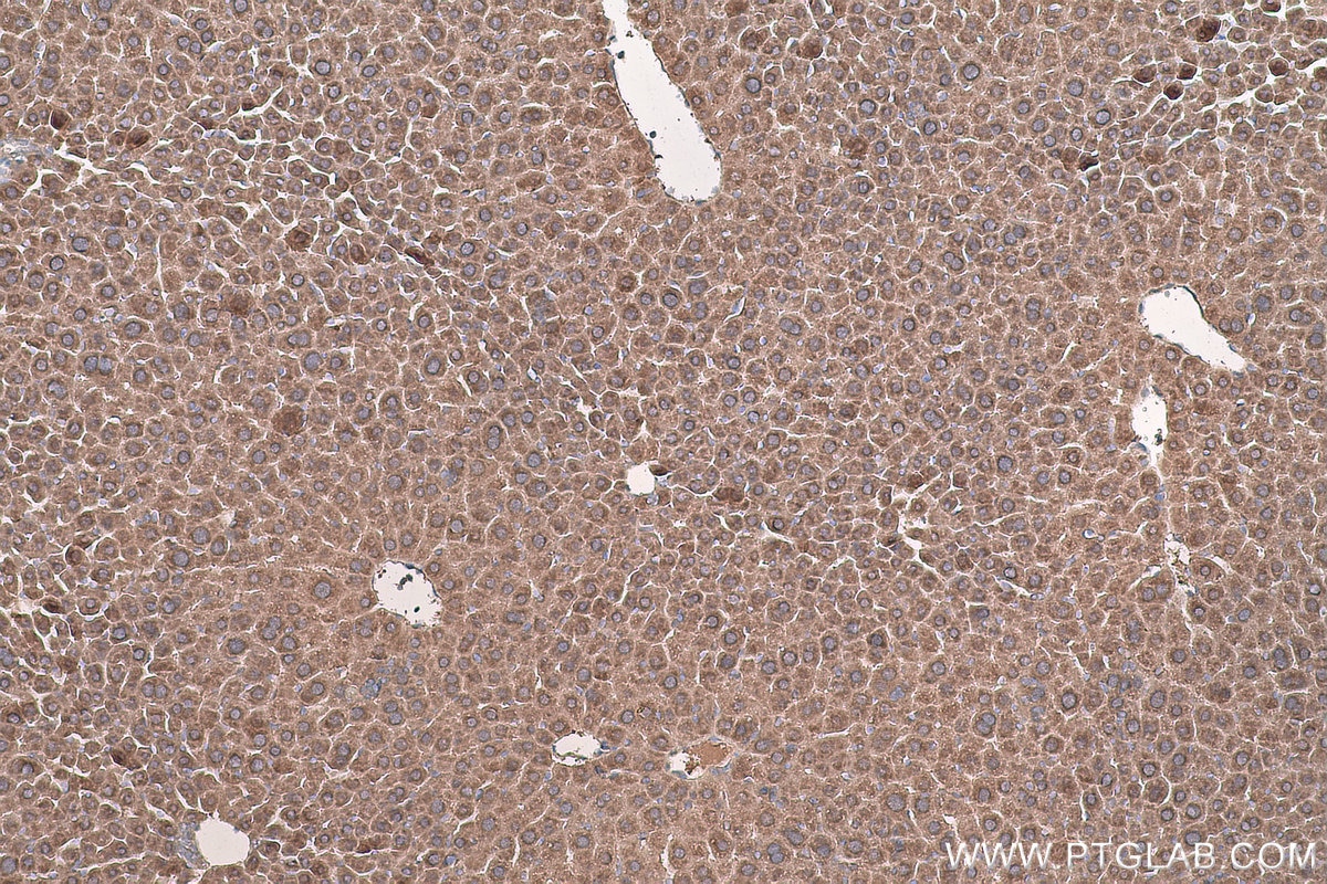 Immunohistochemical analysis of paraffin-embedded mouse liver tissue slide using KHC0791 (GSTO2 IHC Kit).