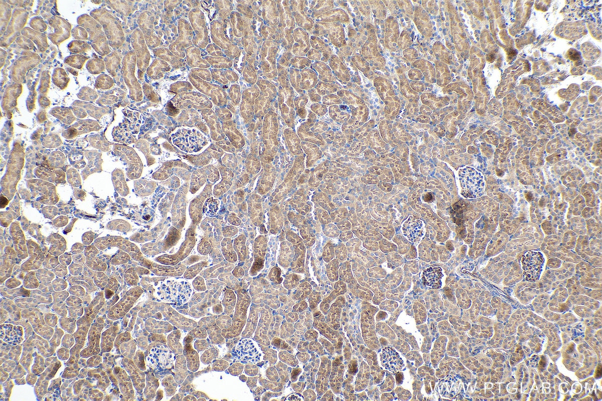 Immunohistochemical analysis of paraffin-embedded mouse kidney tissue slide using KHC0548 (GSTP1 IHC Kit).