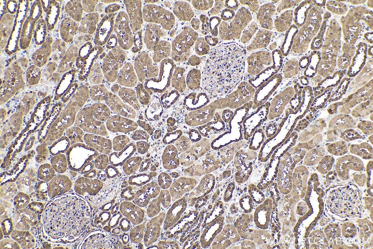 Immunohistochemical analysis of paraffin-embedded human kidney tissue slide using KHC0548 (GSTP1 IHC Kit).