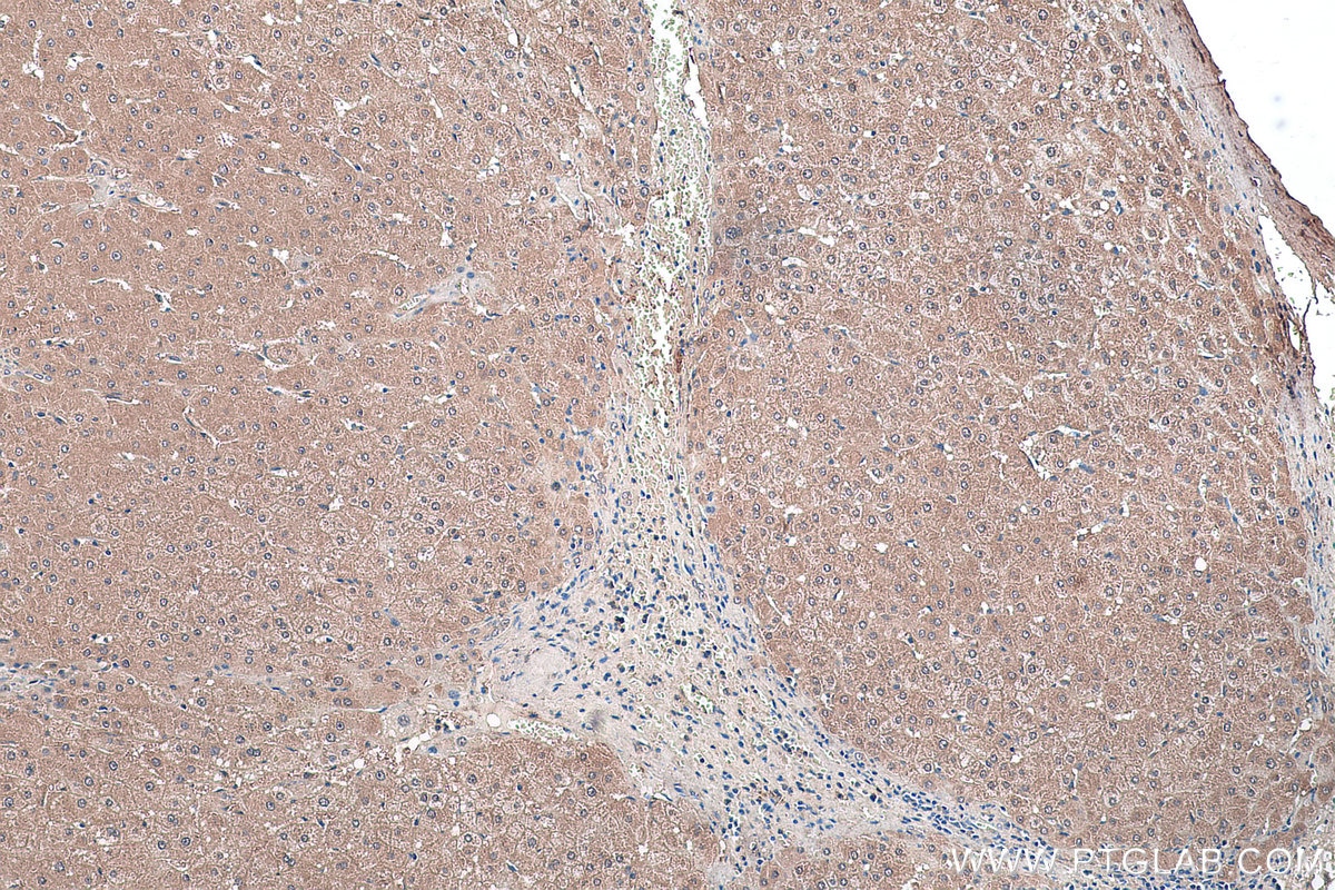 Immunohistochemical analysis of paraffin-embedded human liver tissue slide using KHC0210 (GSTT1 IHC Kit).