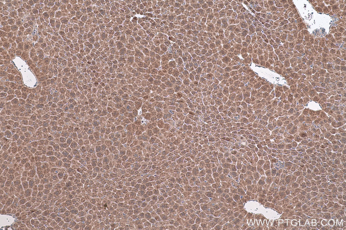 Immunohistochemical analysis of paraffin-embedded mouse liver tissue slide using KHC0792 (GSTT2 IHC Kit).