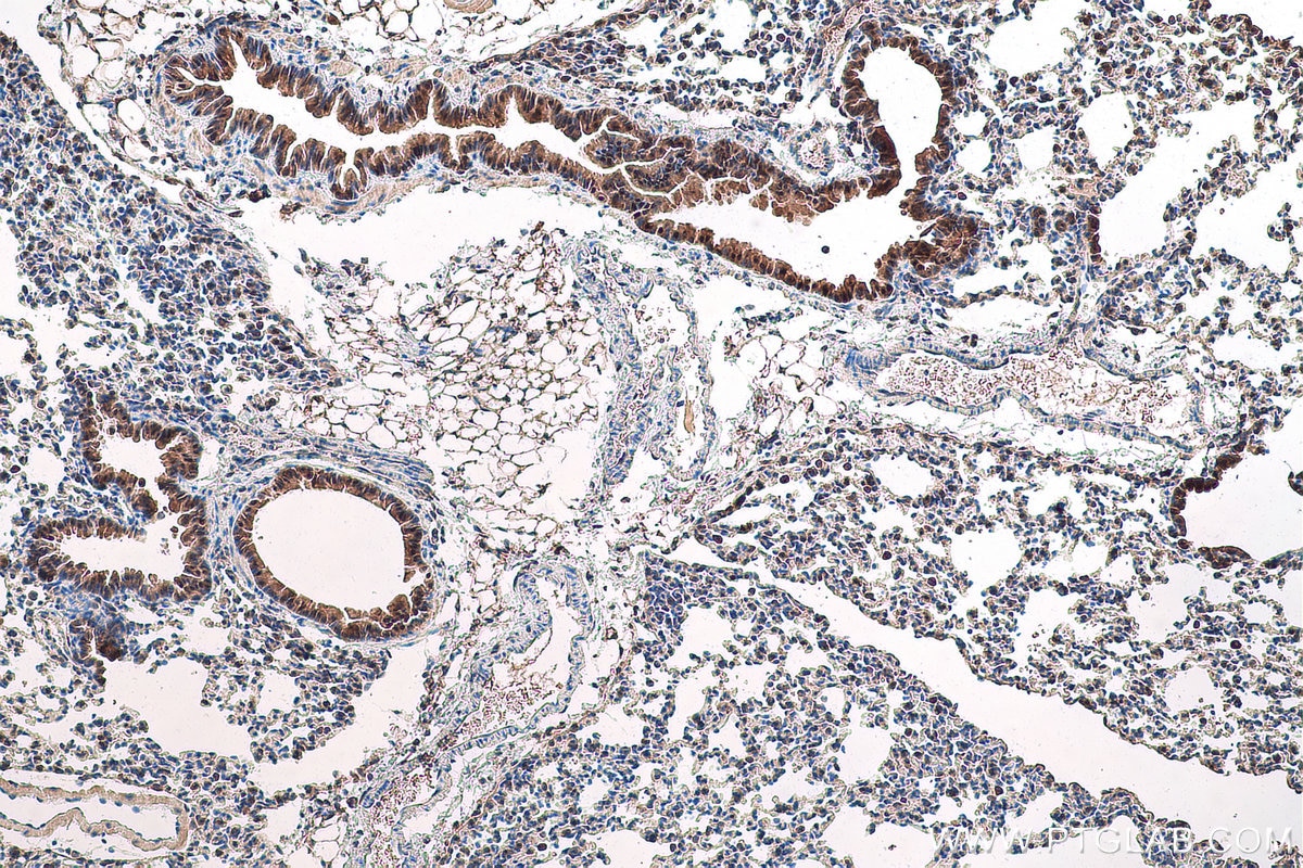 Immunohistochemical analysis of paraffin-embedded mouse lung tissue slide using KHC0792 (GSTT2 IHC Kit).