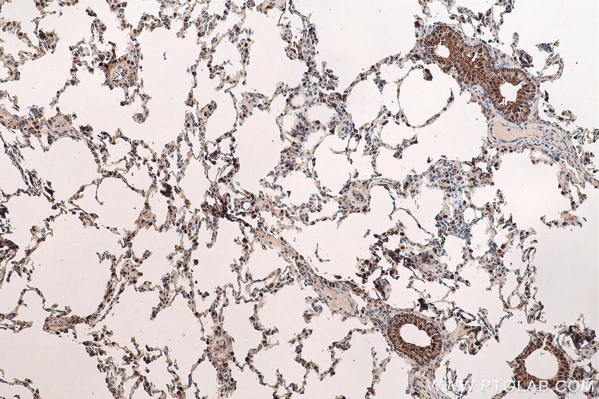 Immunohistochemical analysis of paraffin-embedded rat lung tissue slide using KHC0792 (GSTT2 IHC Kit).