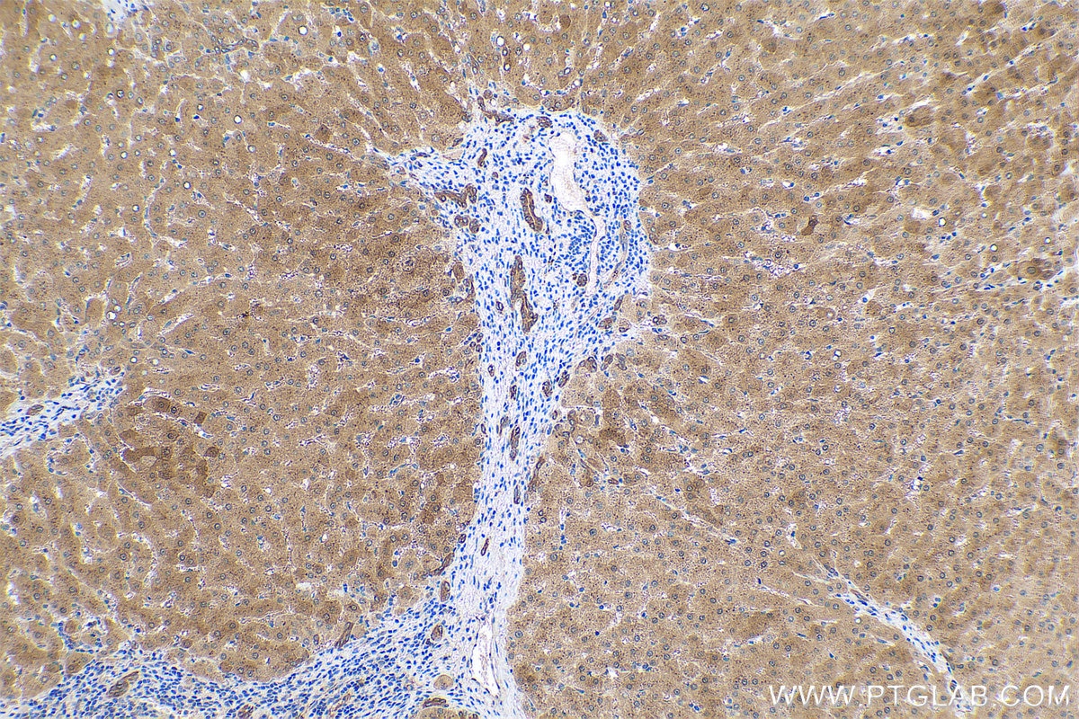 Immunohistochemical analysis of paraffin-embedded human liver tissue slide using KHC0793 (GSTT2B IHC Kit).