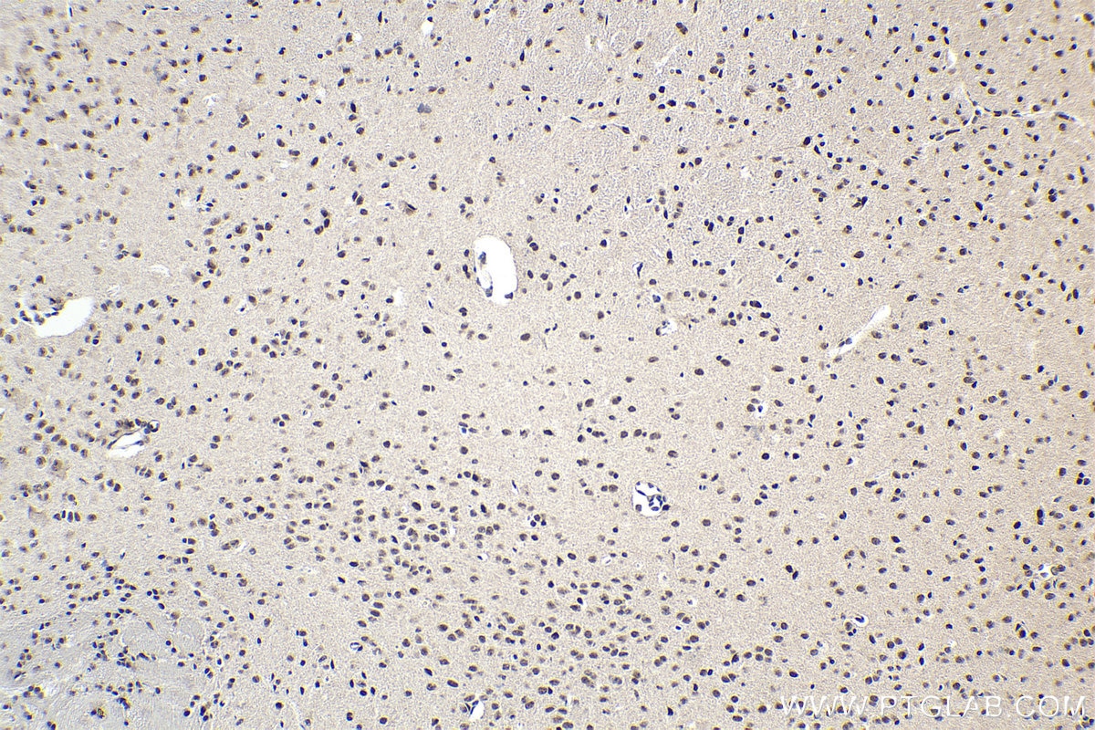 Immunohistochemical analysis of paraffin-embedded mouse brain tissue slide using KHC1604 (GTF2E1 IHC Kit).