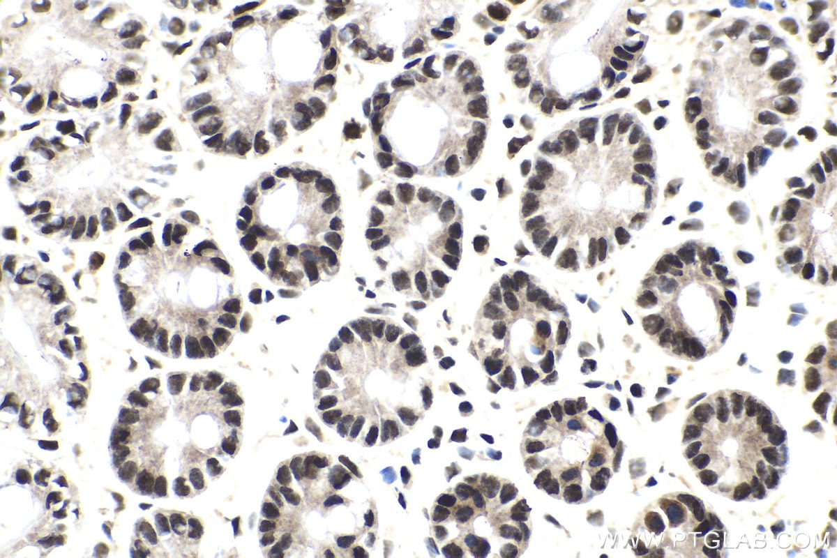 Immunohistochemical analysis of paraffin-embedded mouse small intestine tissue slide using KHC1604 (GTF2E1 IHC Kit).