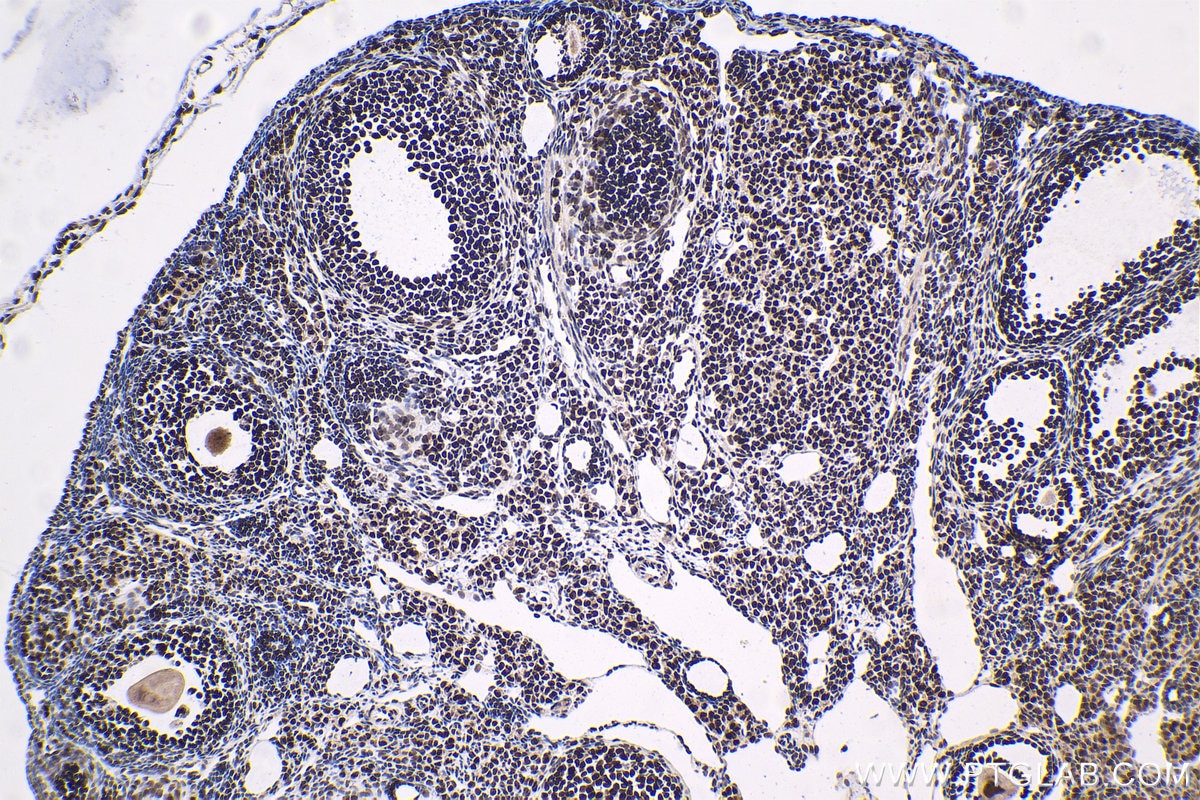 Immunohistochemical analysis of paraffin-embedded mouse ovary tissue slide using KHC1583 (GTF2F1 IHC Kit).