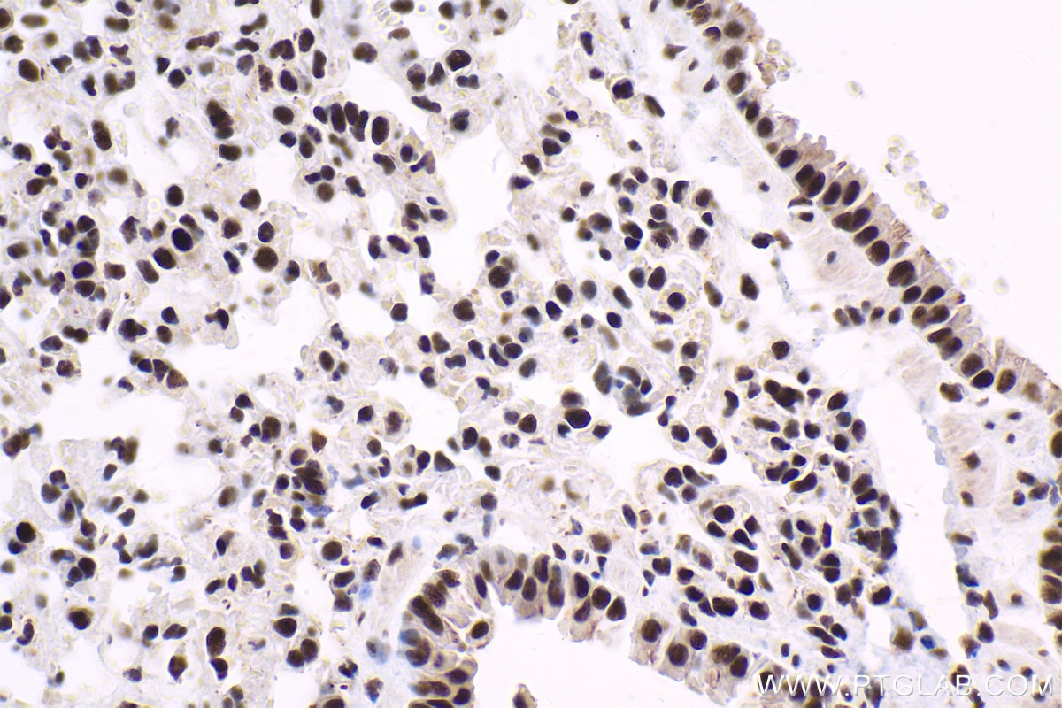 Immunohistochemical analysis of paraffin-embedded mouse lung tissue slide using KHC1583 (GTF2F1 IHC Kit).