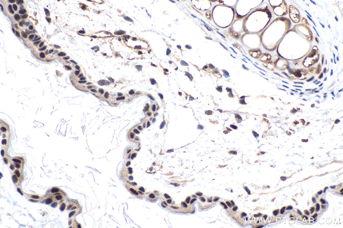 Immunohistochemical analysis of paraffin-embedded mouse skin tissue slide using KHC1530 (GTF2F2 IHC Kit).