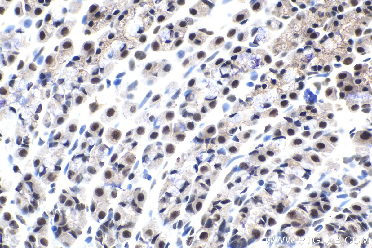 Immunohistochemical analysis of paraffin-embedded rat stomach tissue slide using KHC1530 (GTF2F2 IHC Kit).