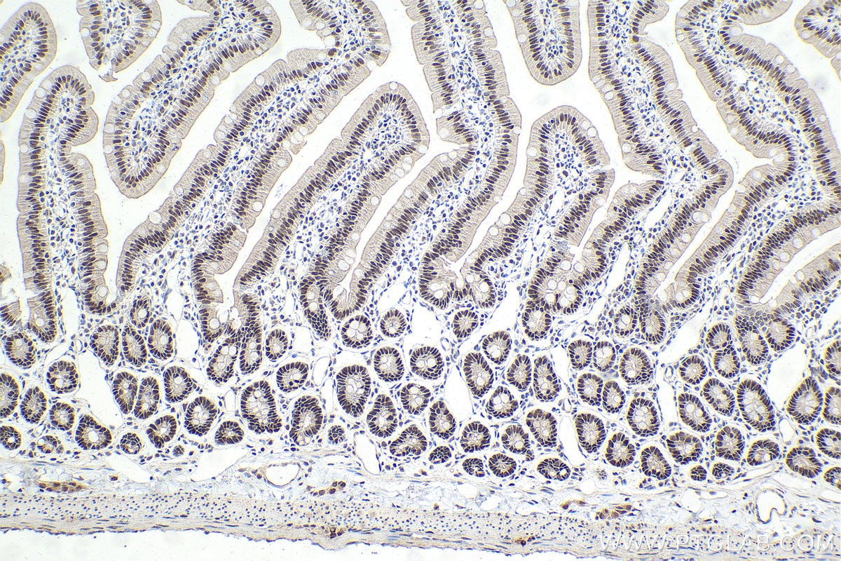 Immunohistochemical analysis of paraffin-embedded rat small intestine tissue slide using KHC1579 (GTF2H1 IHC Kit).