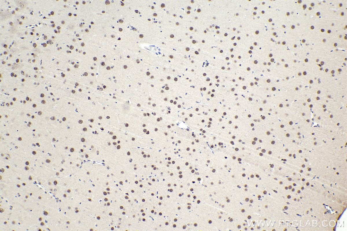 Immunohistochemical analysis of paraffin-embedded rat brain tissue slide using KHC1579 (GTF2H1 IHC Kit).