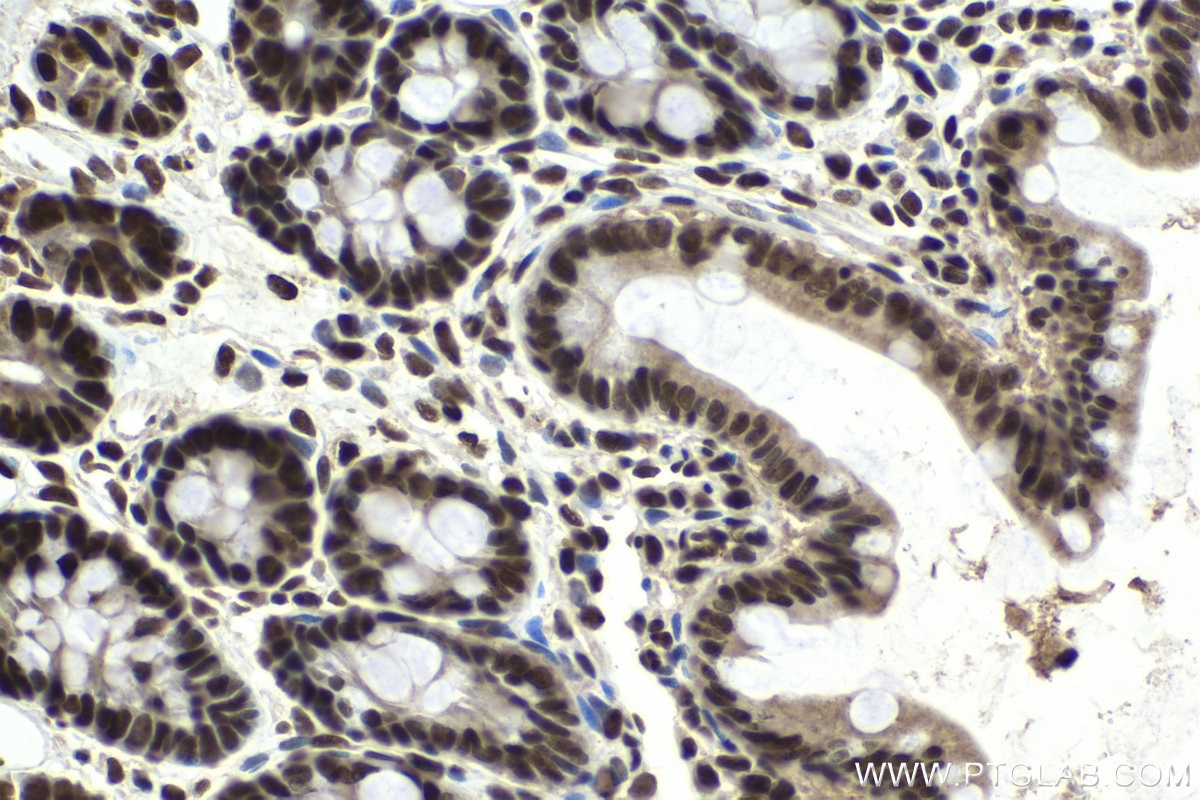 Immunohistochemical analysis of paraffin-embedded rat small intestine tissue slide using KHC1653 (GTF2I IHC Kit).