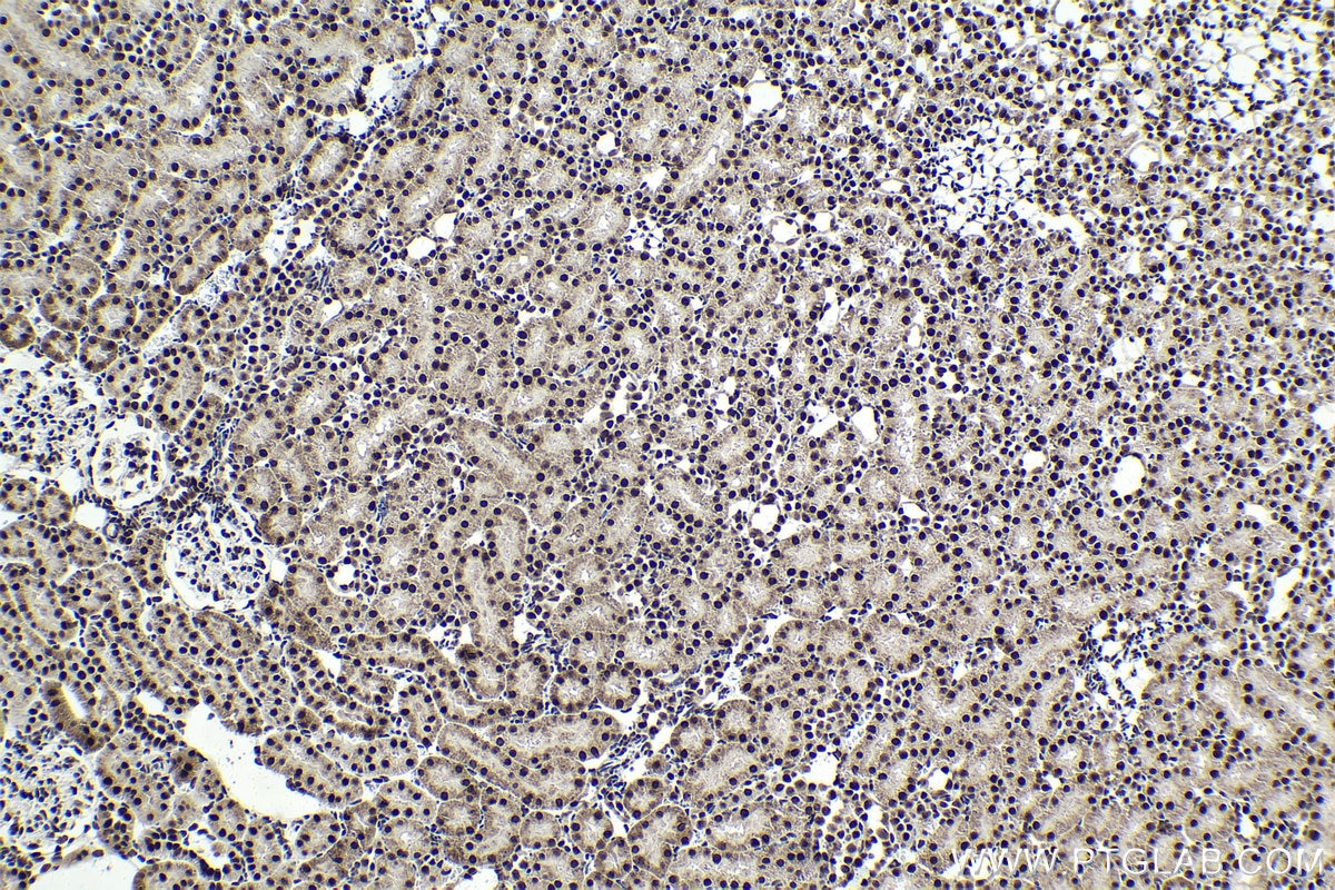 Immunohistochemical analysis of paraffin-embedded rat kidney tissue slide using KHC1653 (GTF2I IHC Kit).