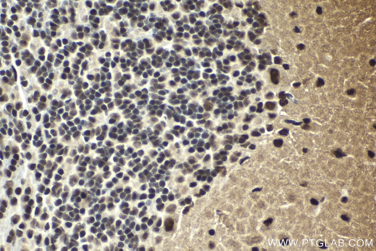 Immunohistochemical analysis of paraffin-embedded rat cerebellum tissue slide using KHC1653 (GTF2I IHC Kit).