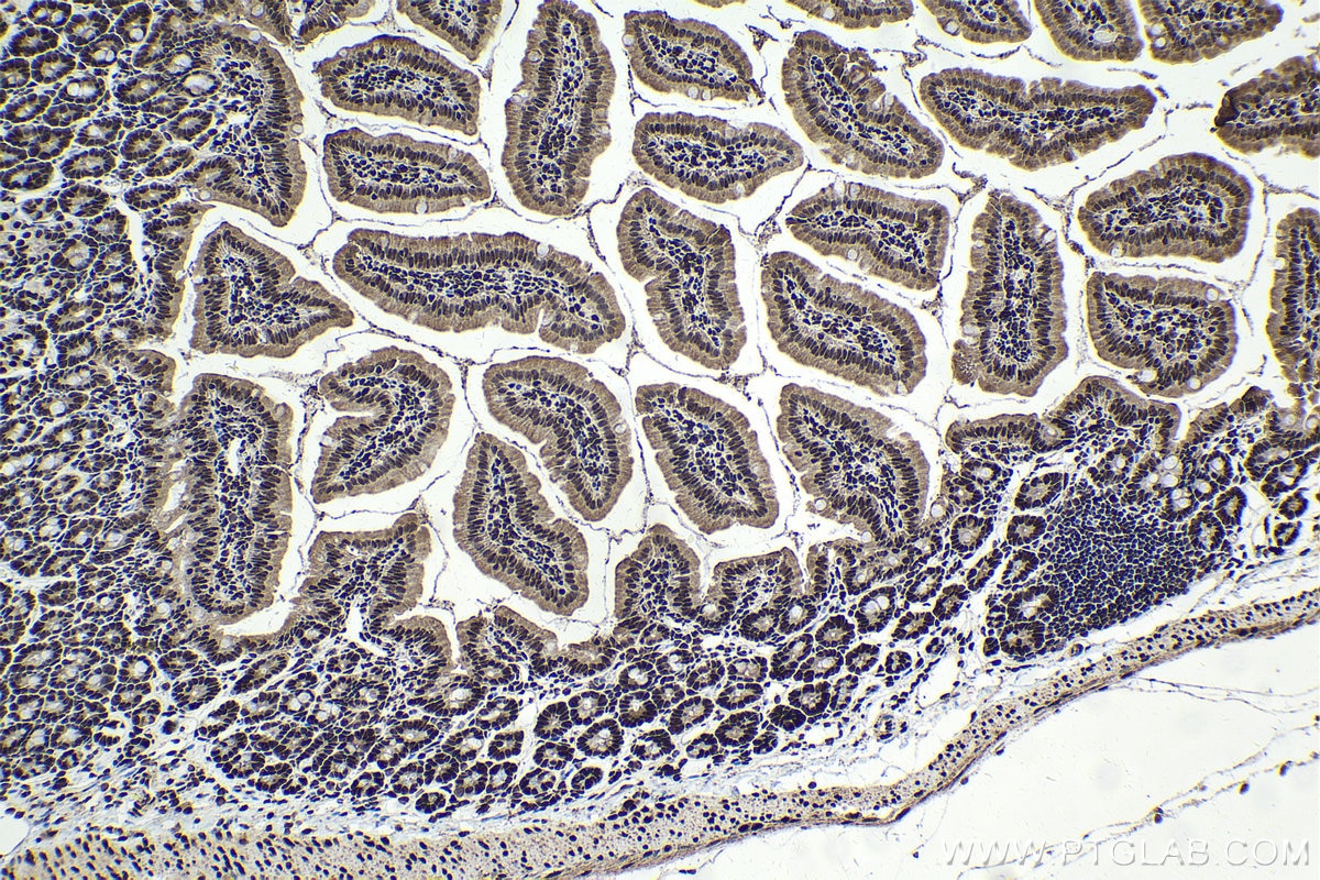 Immunohistochemical analysis of paraffin-embedded mouse small intestine tissue slide using KHC1653 (GTF2I IHC Kit).