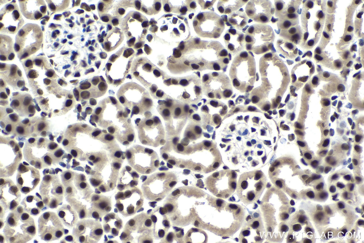 Immunohistochemical analysis of paraffin-embedded mouse kidney tissue slide using KHC1653 (GTF2I IHC Kit).
