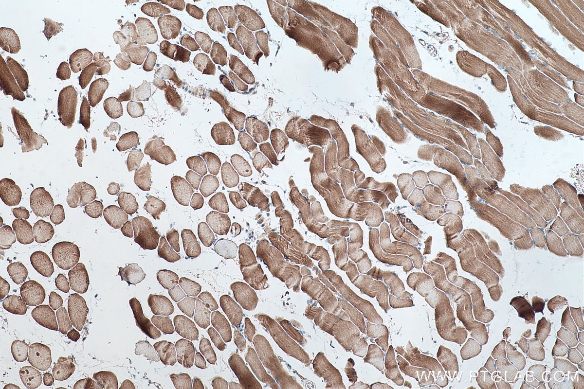 Immunohistochemical analysis of paraffin-embedded mouse skeletal muscle tissue slide using KHC0498 (GYS1 IHC Kit).