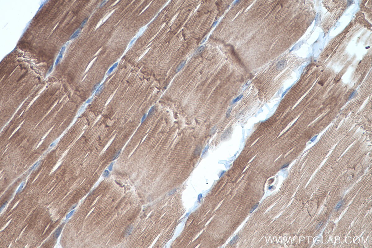 Immunohistochemical analysis of paraffin-embedded rat skeletal muscle tissue slide using KHC0498 (GYS1 IHC Kit).