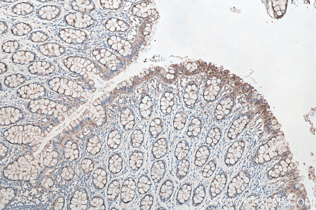 Immunohistochemical analysis of paraffin-embedded human colon tissue slide using KHC0035 (Galectin-3 IHC Kit).