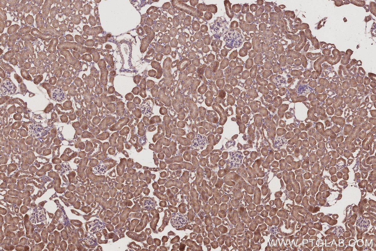 Immunohistochemical analysis of paraffin-embedded mouse kidney tissue slide using KHC3004 (Gamma Adducin IHC Kit).