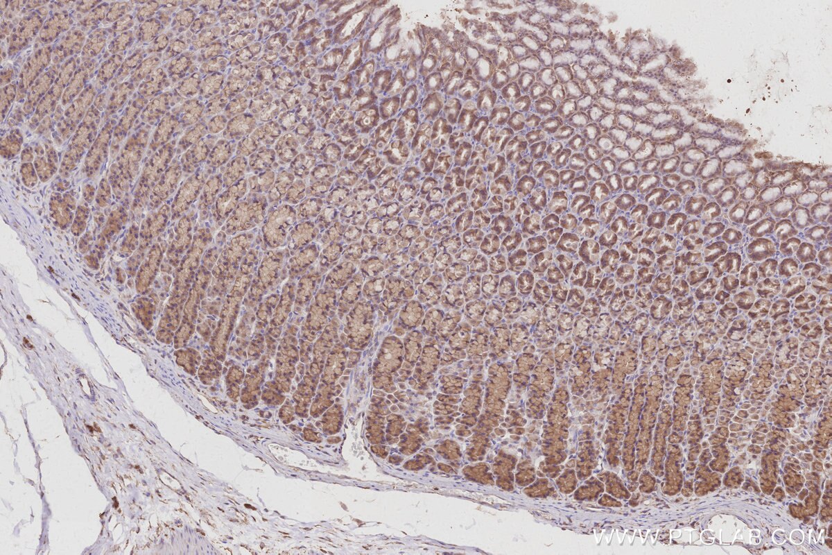 Immunohistochemical analysis of paraffin-embedded rat stomach tissue slide using KHC3004 (Gamma Adducin IHC Kit).