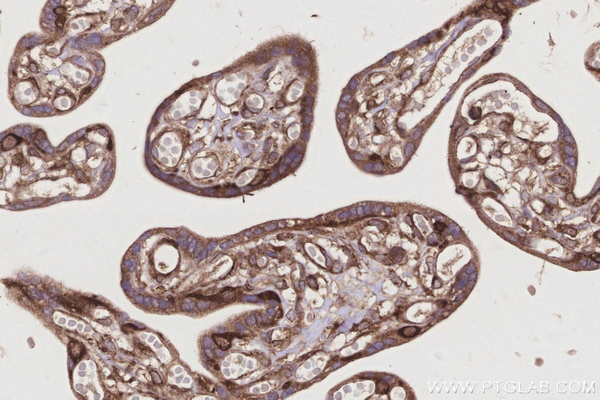 Immunohistochemical analysis of paraffin-embedded human placenta tissue slide using KHC3214 (GlnRS IHC Kit).