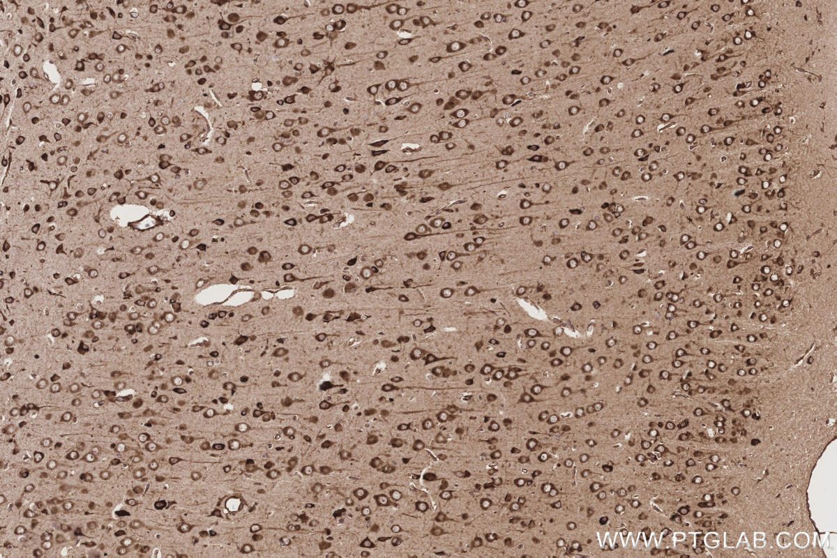 Immunohistochemical analysis of paraffin-embedded rat brain tissue slide using KHC3214 (GlnRS IHC Kit).