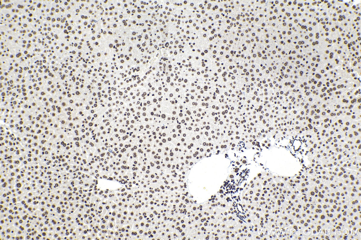 Immunohistochemical analysis of paraffin-embedded mouse liver tissue slide using KHC1551 (H2AX IHC Kit).