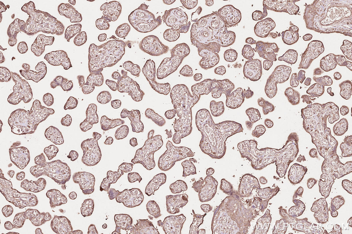 Immunohistochemical analysis of paraffin-embedded human placenta tissue slide using KHC2600 (HACD2/PTPLB IHC Kit).