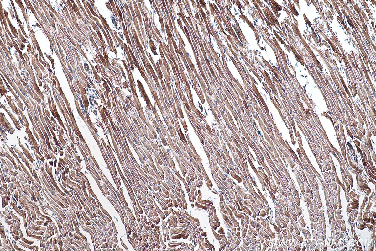 Immunohistochemical analysis of paraffin-embedded mouse heart tissue slide using KHC0553 (HADHA IHC Kit).