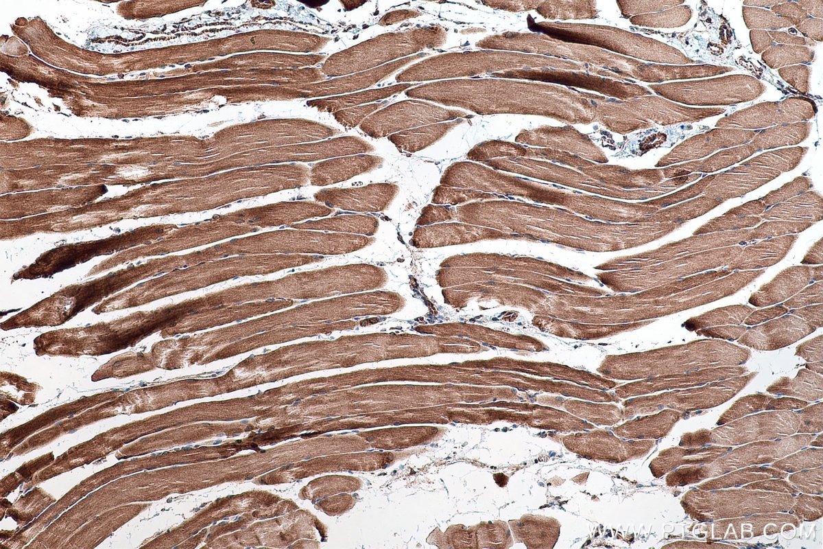 Immunohistochemical analysis of paraffin-embedded mouse skeletal muscle tissue slide using KHC0553 (HADHA IHC Kit).